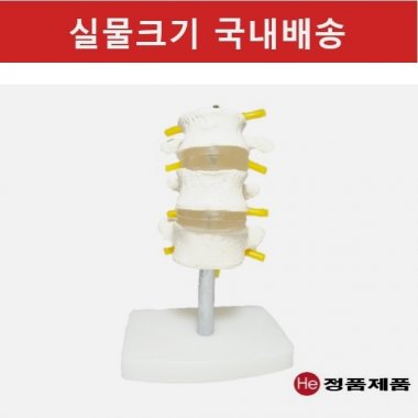 3마디 요추모형 7003GG 인체모형 사람인체구조 아나토미 뇌구조 대뇌 위모형 간모형 뇌모형 두개골 척추 인대 근육모형 인체해부도 뇌혈관 전신모형 동인형 뇌해부 인체모형 소형 사람인체구조 아나토미 위모형 간모형 뇌모형 두개골 척추 인대 근육모형 인체해부도 척골 요골 전신모형 동인형 경혈인형 손모형 발모형